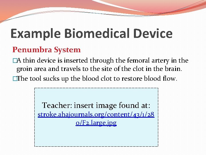 Example Biomedical Device Penumbra System �A thin device is inserted through the femoral artery