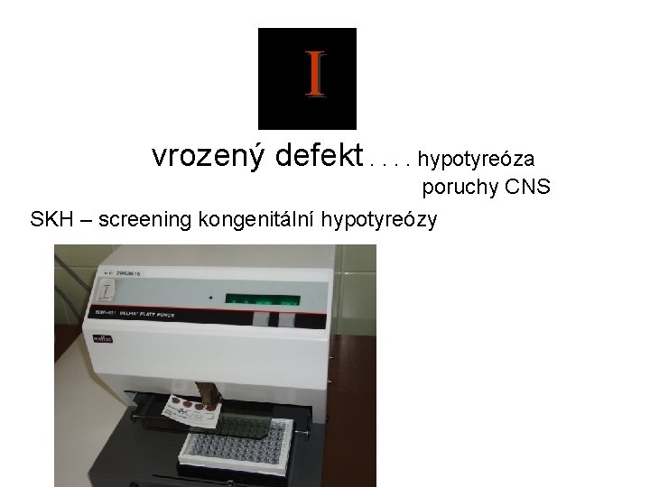  I vrozený defekt. . hypotyreóza poruchy CNS SKH – screening kongenitální hypotyreózy 