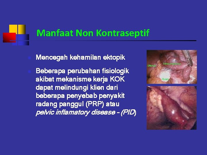 Manfaat Non Kontraseptif n n Mencegah kehamilan ektopik Beberapa perubahan fisiologik akibat mekanisme kerja