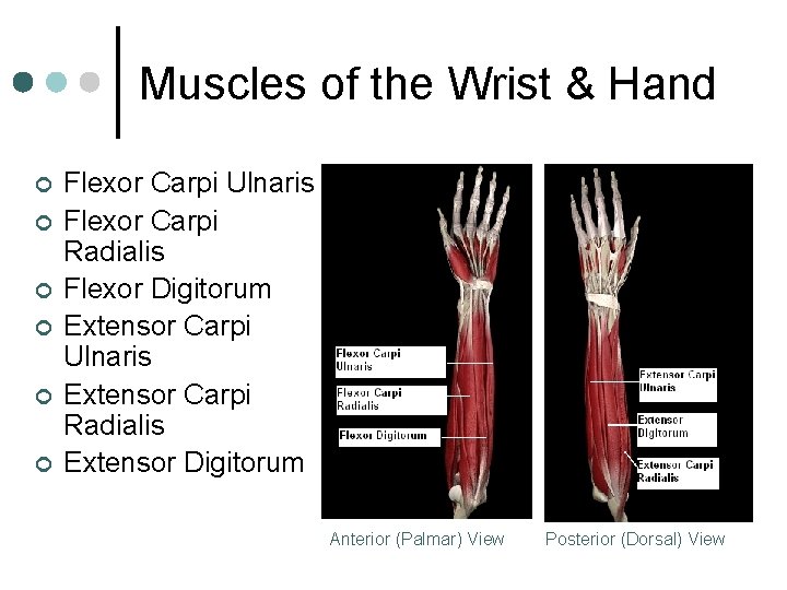 Muscles of the Wrist & Hand ¢ ¢ ¢ Flexor Carpi Ulnaris Flexor Carpi