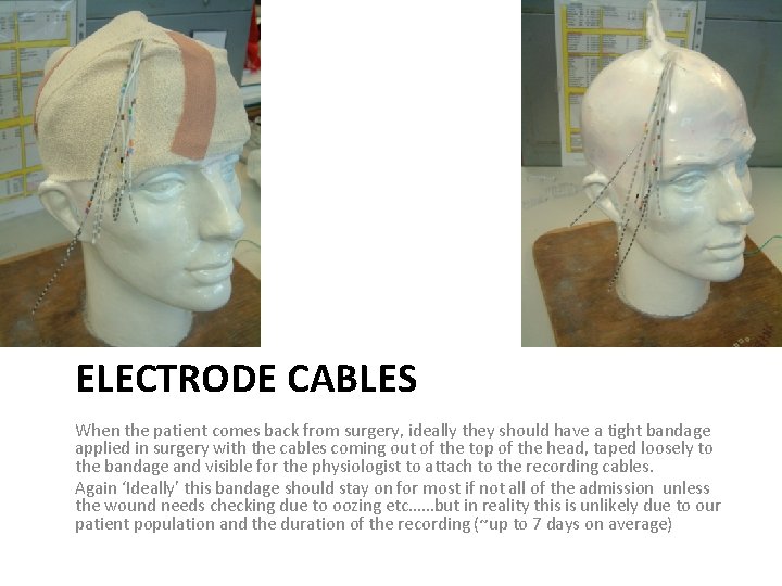 ELECTRODE CABLES When the patient comes back from surgery, ideally they should have a