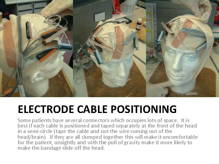 ELECTRODE CABLE POSITIONING Some patients have several connectors which occupies lots of space. It