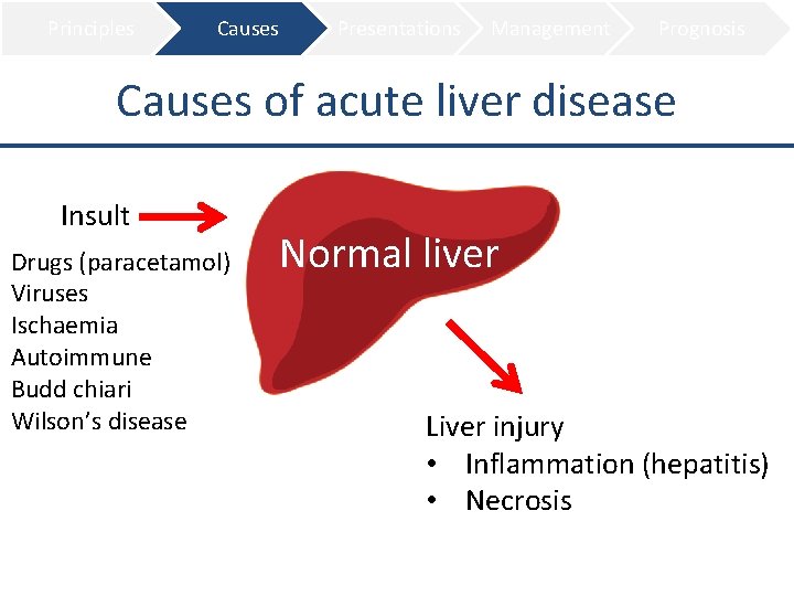 Principles Causes Presentations Management Prognosis Causes of acute liver disease Insult Drugs (paracetamol) Viruses