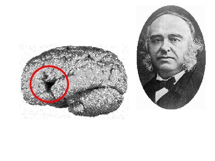 Paul Broca [1800 s] • Suggested localization 