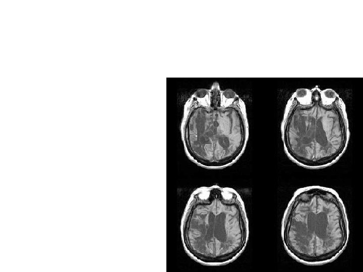 Techniques to examine functions of the brain 1. Remove part of the brain &