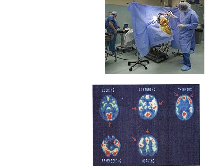 3. Stimulate the brain 4. Record brain activity 