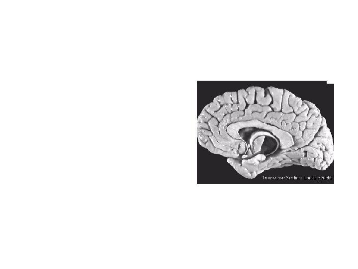 Our Divided Brains • Corpus collosum – large bundle of neural fibers (myelinated axons,