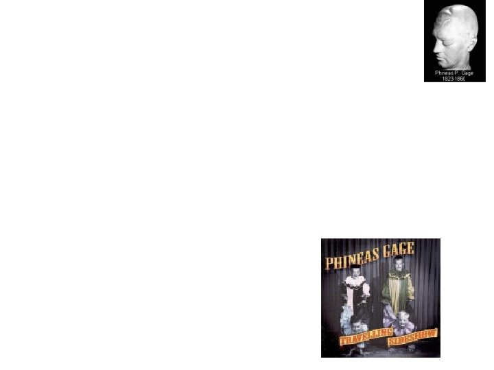 Phineas Gage • Accident – Quick Recovery • Months later: “No longer Gage” –