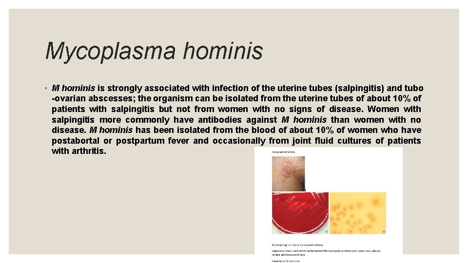 Mycoplasma hominis ◦ M hominis is strongly associated with infection of the uterine tubes