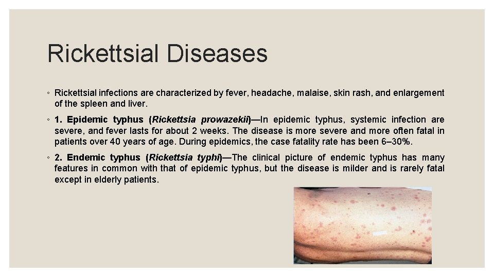 Rickettsial Diseases ◦ Rickettsial infections are characterized by fever, headache, malaise, skin rash, and