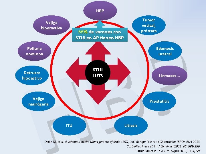 HBP Vejiga hiperactiva Tumor vesical, próstata P B H 66% de varones con STUI