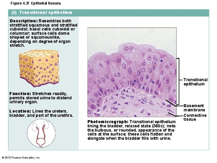 Figure 4. 3 f Epithelial tissues. Transitional epithelium Description: Resembles both stratified squamous and