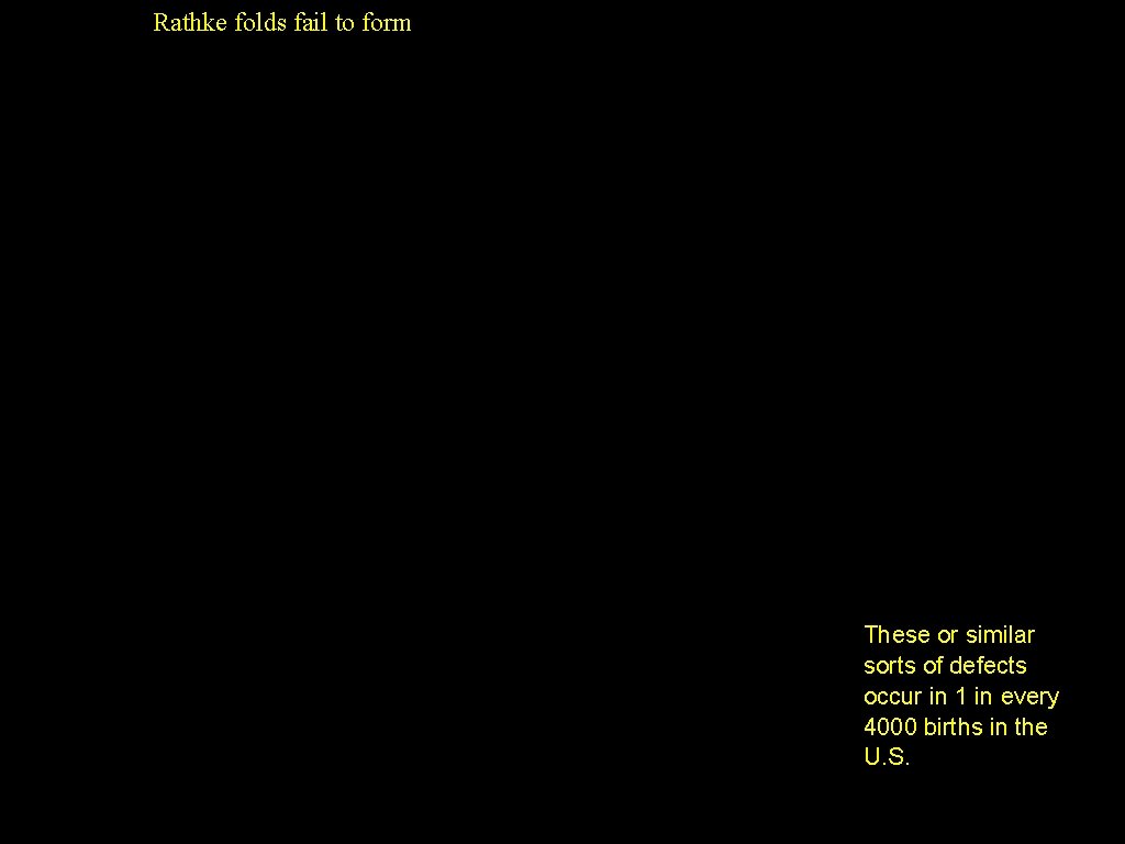 Rathke folds fail to form These or similar sorts of defects occur in 1