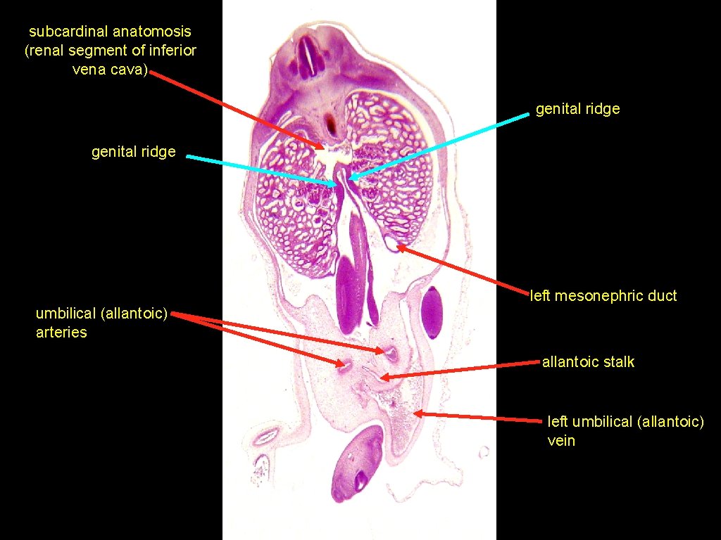 subcardinal anatomosis (renal segment of inferior vena cava) genital ridge left mesonephric duct umbilical