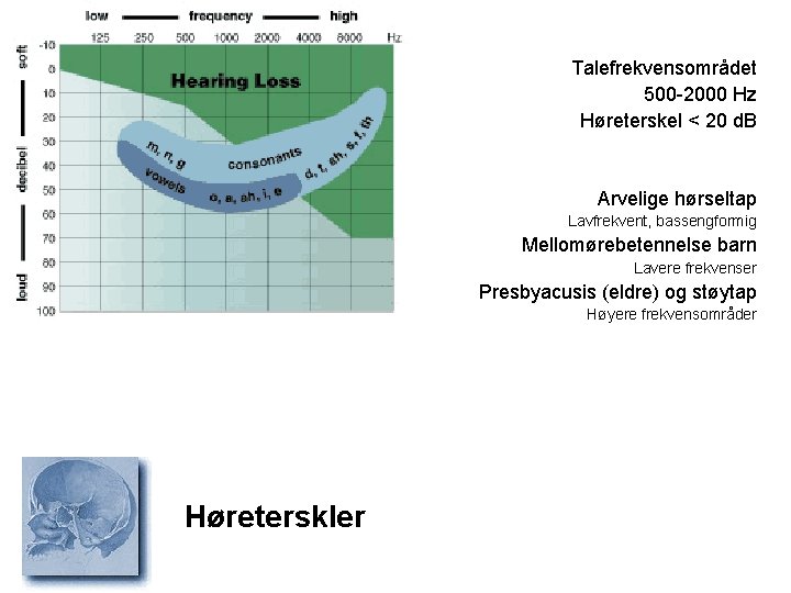 Talefrekvensområdet 500 -2000 Hz Høreterskel < 20 d. B Arvelige hørseltap Lavfrekvent, bassengformig Mellomørebetennelse