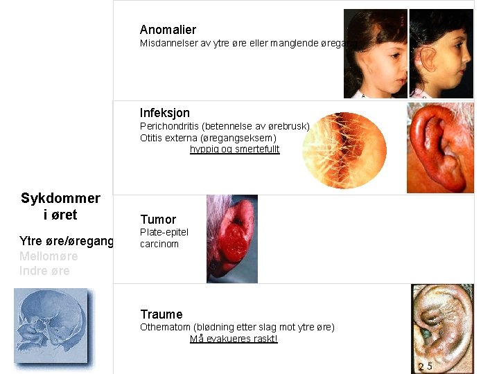 Anomalier Misdannelser av ytre øre eller manglende øregang Infeksjon Perichondritis (betennelse av ørebrusk) Otitis