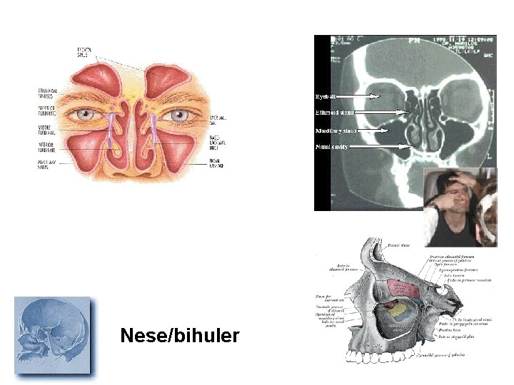 Nese/bihuler 