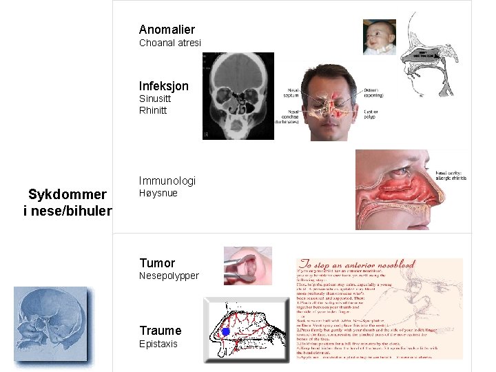 Anomalier Choanal atresi Infeksjon Sinusitt Rhinitt Sykdommer i nese/bihuler Immunologi Høysnue Tumor Nesepolypper Traume
