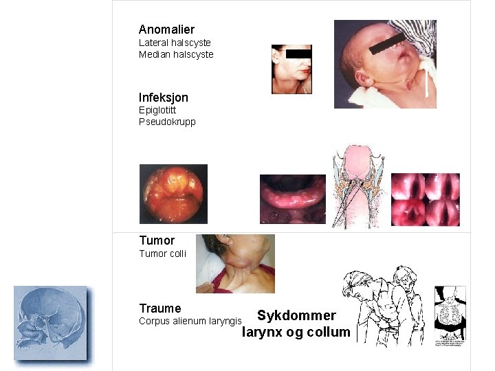 Anomalier Lateral halscyste Median halscyste Infeksjon Epiglotitt Pseudokrupp Tumor colli Traume Sykdommer larynx og