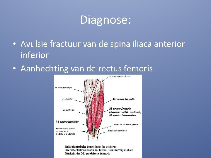 Diagnose: • Avulsie fractuur van de spina iliaca anterior inferior • Aanhechting van de