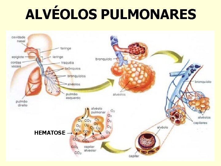 ALVÉOLOS PULMONARES HEMATOSE → 