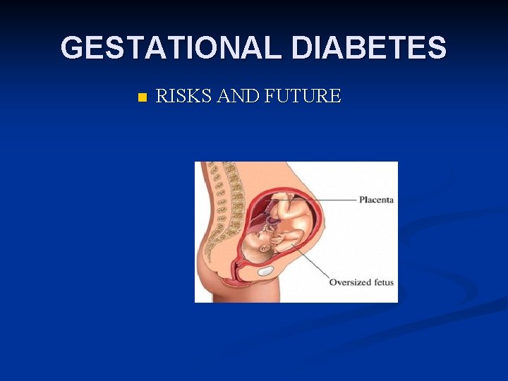 GESTATIONAL DIABETES n RISKS AND FUTURE 