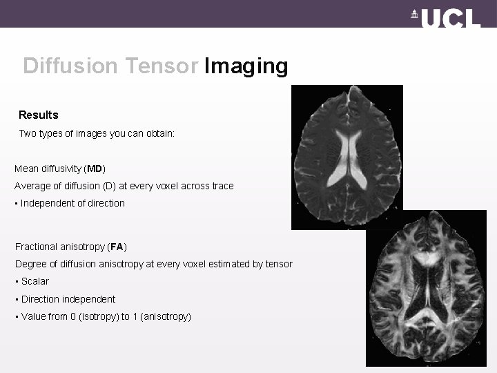 Diffusion Tensor Imaging Results Two types of images you can obtain: Mean diffusivity (MD)