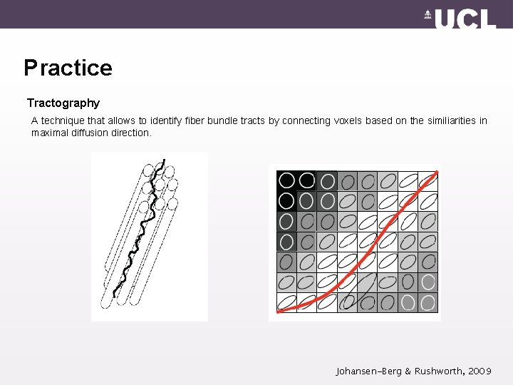Practice Tractography A technique that allows to identify fiber bundle tracts by connecting voxels