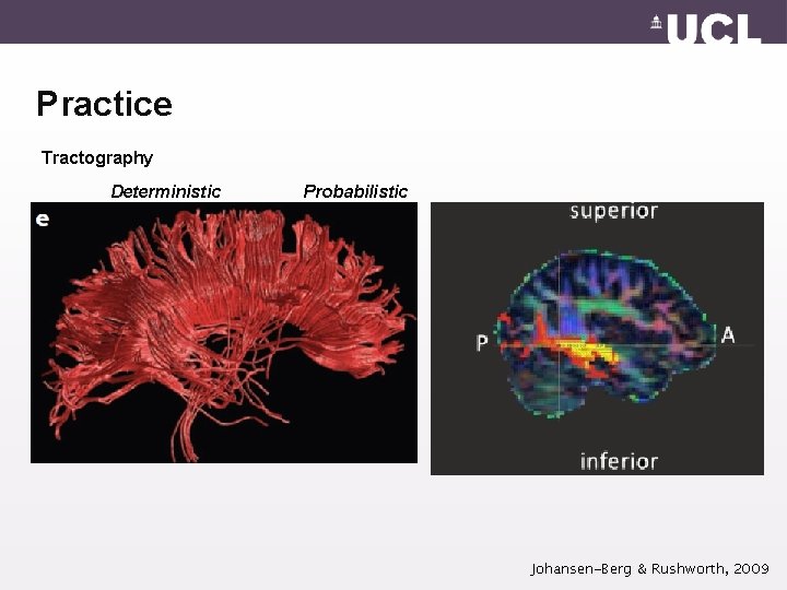Practice Tractography Deterministic Probabilistic Johansen-Berg & Rushworth, 2009 