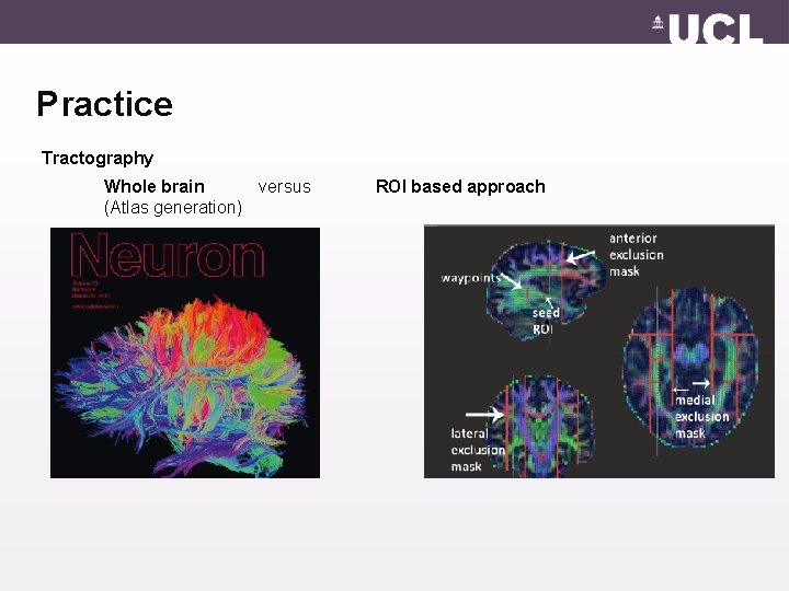 Practice Tractography Whole brain versus (Atlas generation) ROI based approach 