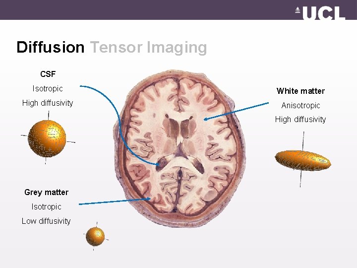 Diffusion Tensor Imaging CSF Isotropic White matter High diffusivity Anisotropic High diffusivity Grey matter