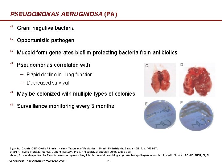 PSEUDOMONAS AERUGINOSA (PA) } Gram negative bacteria } Opportunistic pathogen } Mucoid form generates