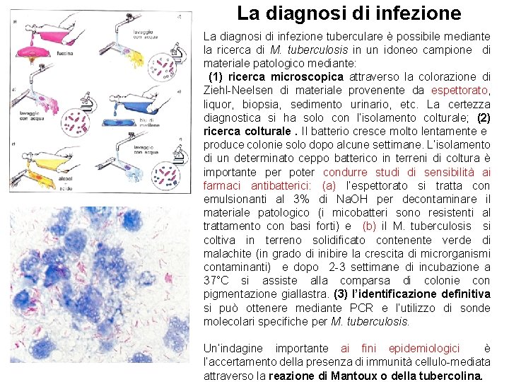 La diagnosi di infezione tuberculare è possibile mediante la ricerca di M. tuberculosis in