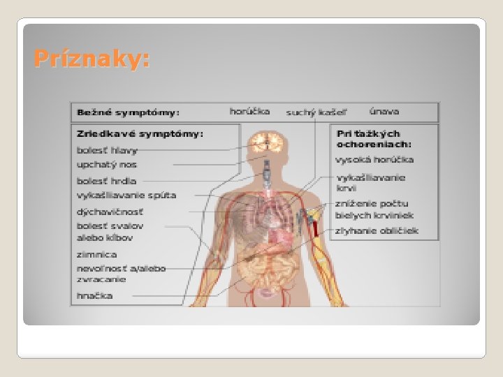 Príznaky: 