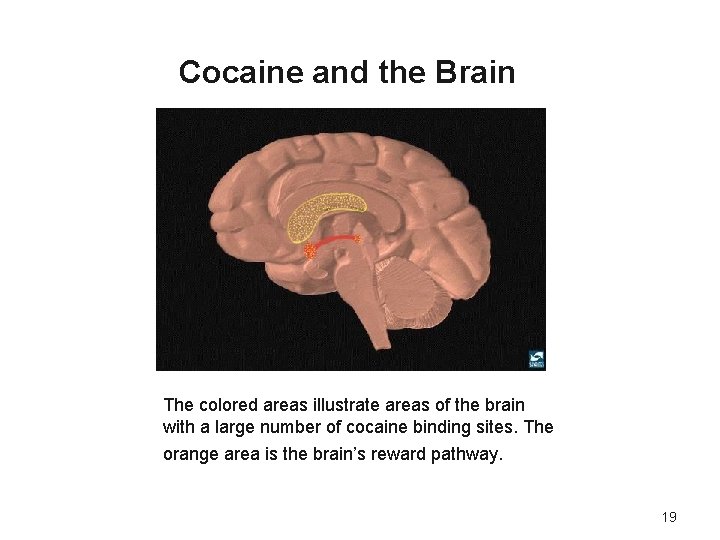 Cocaine and the Brain The colored areas illustrate areas of the brain with a