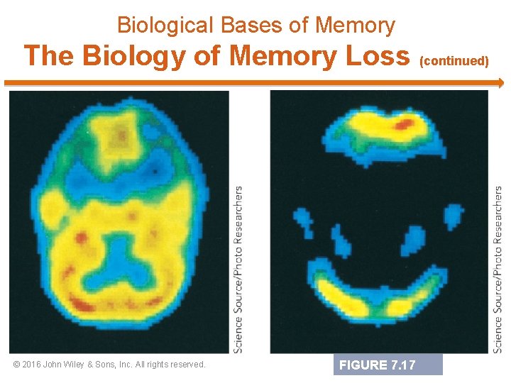 Biological Bases of Memory The Biology of Memory Loss (continued) © 2016 John Wiley