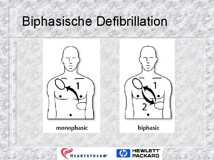 Biphasische Defibrillation 