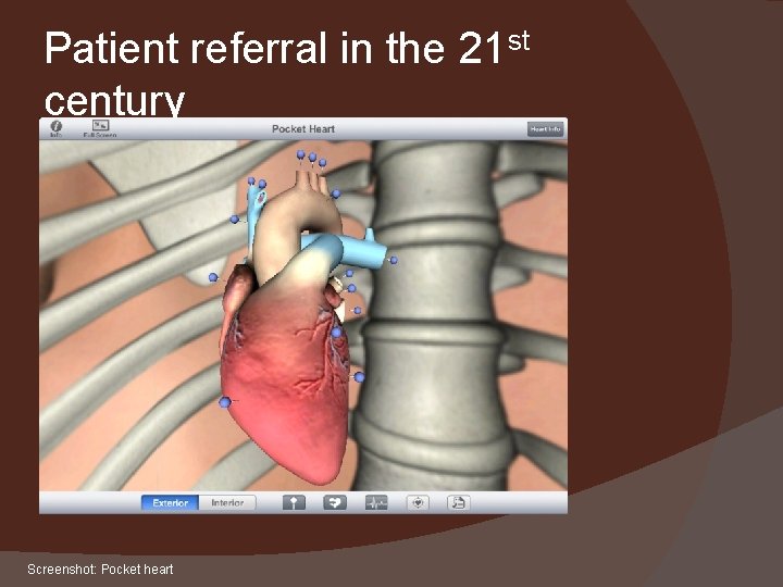 Patient referral in the 21 st century Screenshot: Pocket heart 