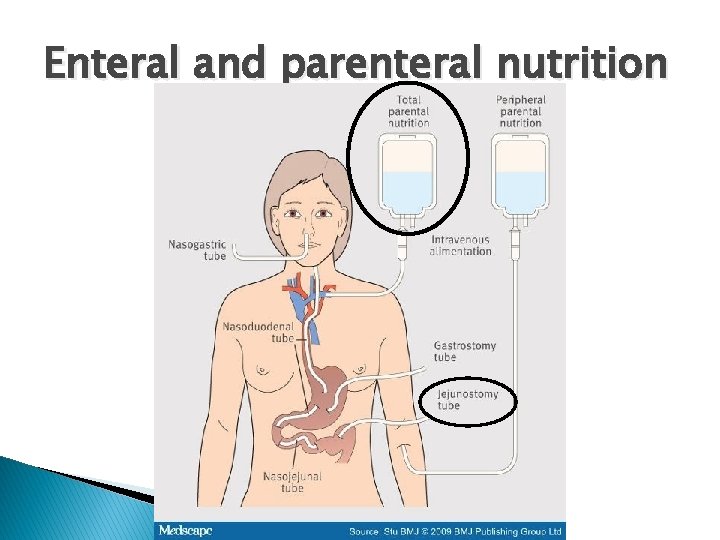 Enteral and parenteral nutrition 