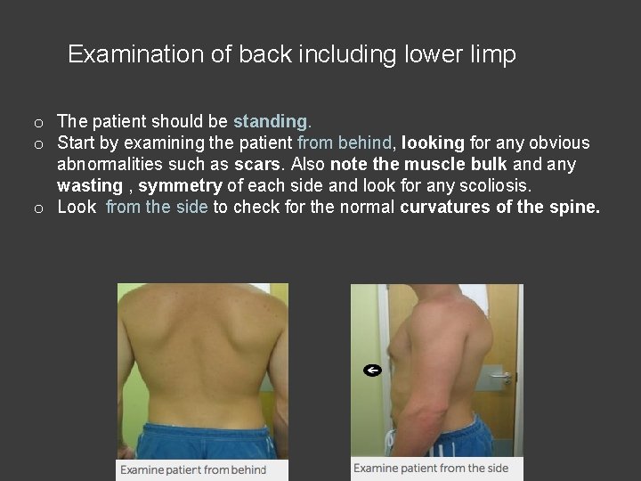 Examination of back including lower limp o The patient should be standing. o Start