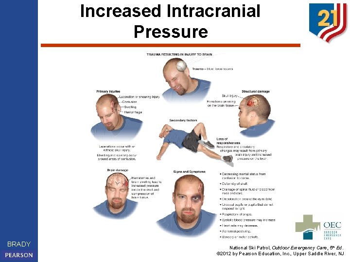 Increased Intracranial Pressure BRADY National Ski Patrol, Outdoor Emergency Care, 5 th Ed. ©