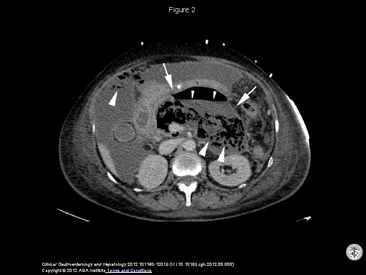 Figure 2 Clinical Gastroenterology and Hepatology 2012 101190 -1201 DOI: (10. 1016/j. cgh. 2012.