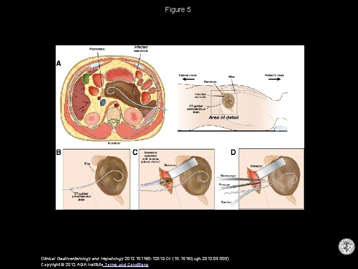 Figure 5 Clinical Gastroenterology and Hepatology 2012 101190 -1201 DOI: (10. 1016/j. cgh. 2012.