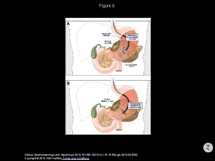 Figure 6 Clinical Gastroenterology and Hepatology 2012 101190 -1201 DOI: (10. 1016/j. cgh. 2012.