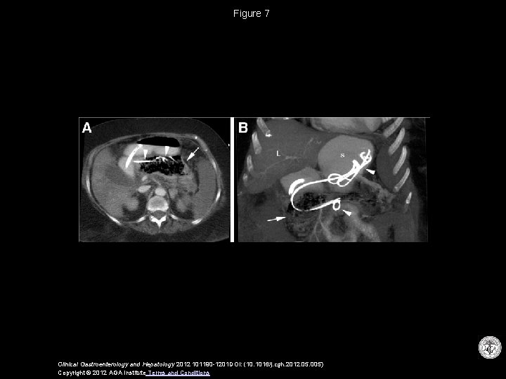 Figure 7 Clinical Gastroenterology and Hepatology 2012 101190 -1201 DOI: (10. 1016/j. cgh. 2012.