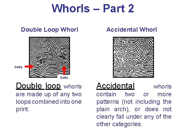 Whorls – Part 2 Double Loop Whorl Accidental Whorl Delta Double loop whorls are