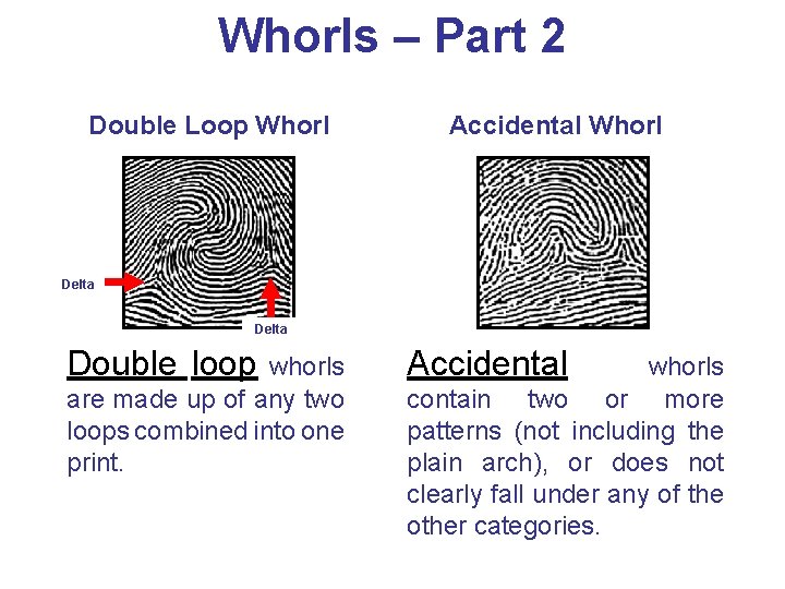 Whorls – Part 2 Double Loop Whorl Accidental Whorl Delta Double loop whorls are Whorls – Part 2 Double Loop Whorl Accidental Whorl Delta Double loop whorls are