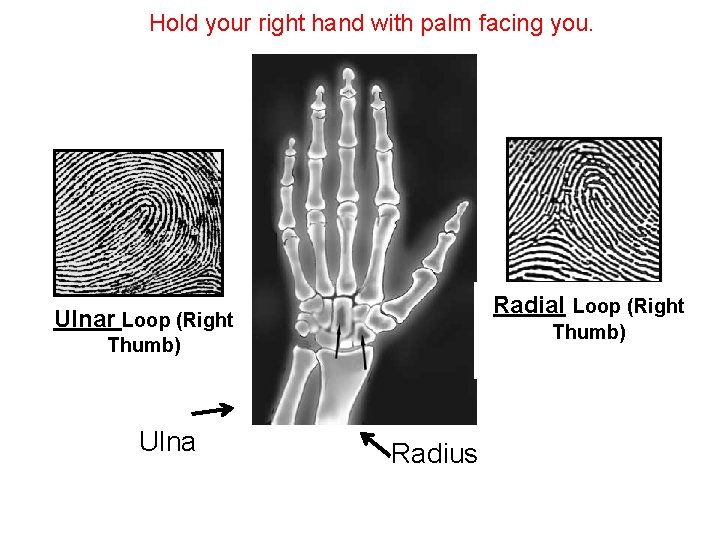 Hold your right hand with palm facing you. Radial Loop (Right Ulnar Loop (Right