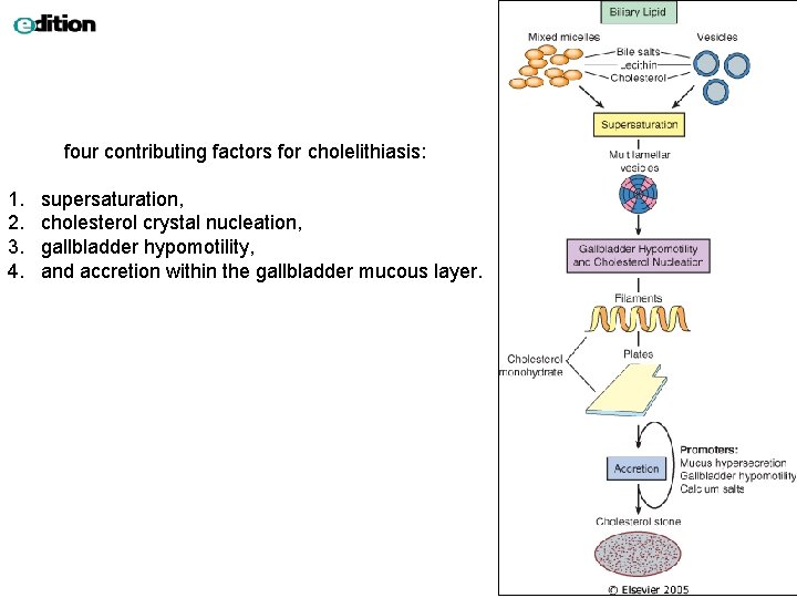  four contributing factors for cholelithiasis: 1. 2. 3. 4. supersaturation, cholesterol crystal nucleation,