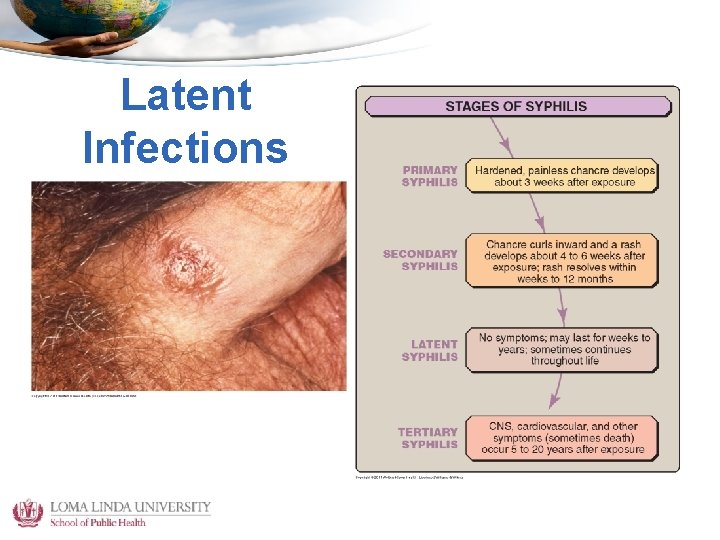 Latent Infections 